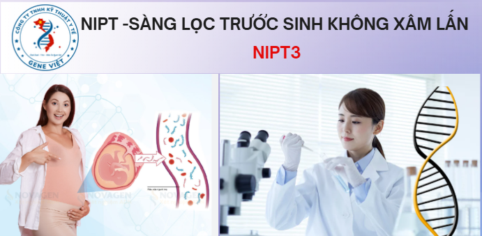 Gói xét nghiệm NIPT3 sàng lọc trước sinh an toàn chính xác 2026