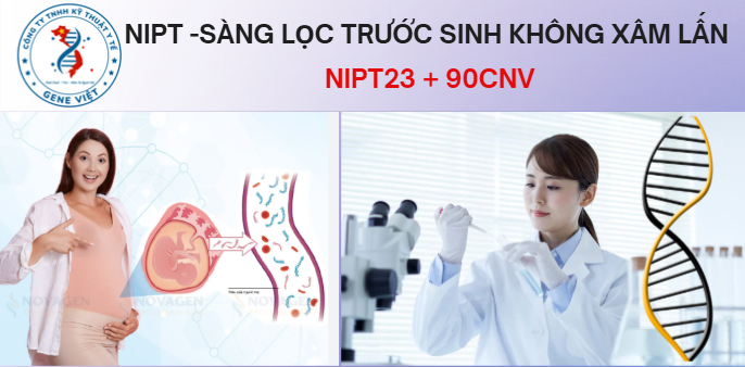 NIPT 23 & 90CNV sàng lọc trước sinh toàn diện nhất cho mẹ bầu 2026