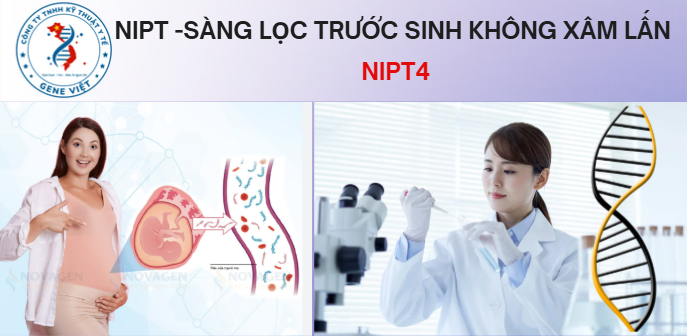 Gói xét nghiệm NIPT4 sàng lọc trước sinh mở rộng cho mẹ bầu 2026