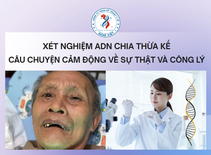 Xét nghiệm ADN làm rõ huyết thống để chia tài sản thừa kế