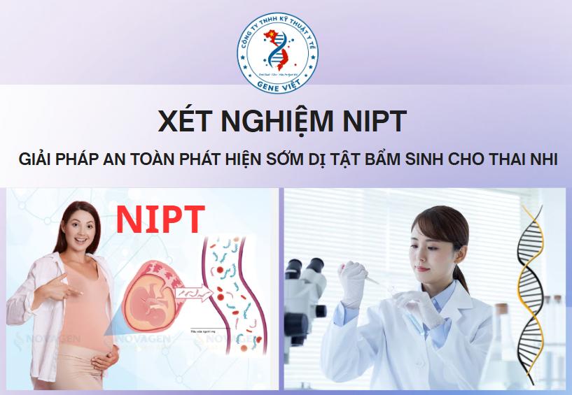 Xét nghiệm NIPT giải pháp an toàn phát hiện sớm dị tật bẩm sinh 2026