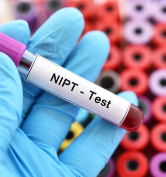 Xét nghiệm sàng lọc trước sinh NIPT