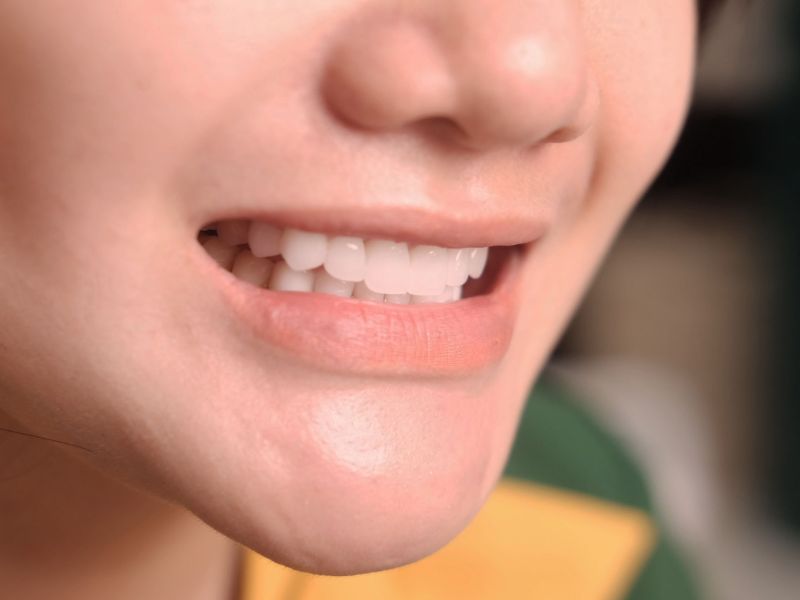 Răng Sứ Thẩm Mỹ: Giải Mã Chi Phí & Bí Quyết Sở Hữu Nụ Cười Đẳng Cấp Bậc Nhất