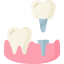 Trồng răng Implant