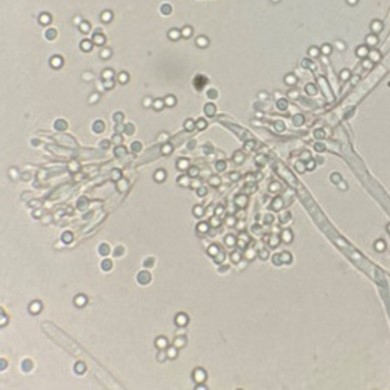 Penicillium simplicissimum