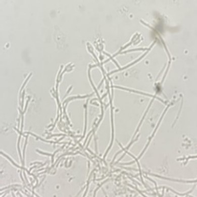 Penicillium janthinellum