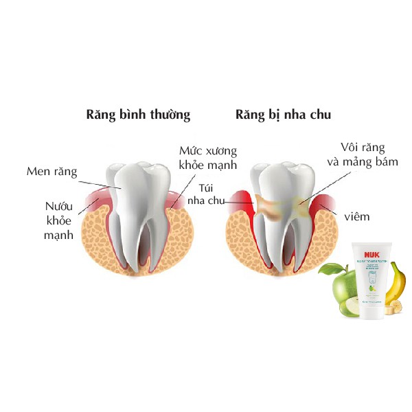 KEM ĐÁNH RĂNG TRẺ EM NUK KHÔNG FLOURIDE 3-36 THÁNG (50G)