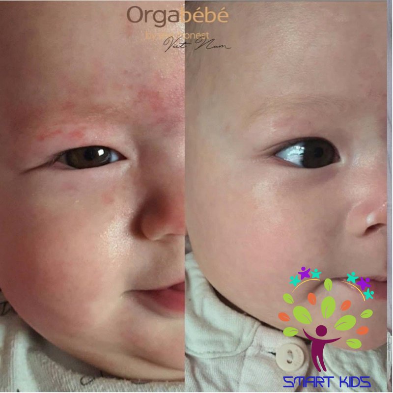 Kem dưỡng ẩm cho bé Peptide Ato Cream ORGABÉBÉ Hàn Quốc 150ml