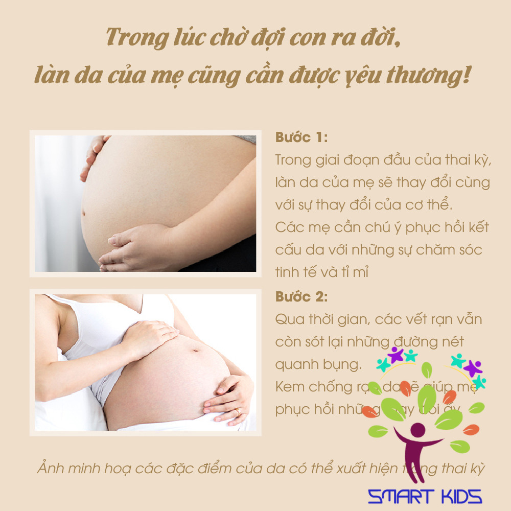 Kem Rạn Da Cho Bà Bầu ATONO2, Giúp Chống Rạn Da Trước Và Sau Sinh, Giảm Mờ Thâm Sẹo, Made in Korea