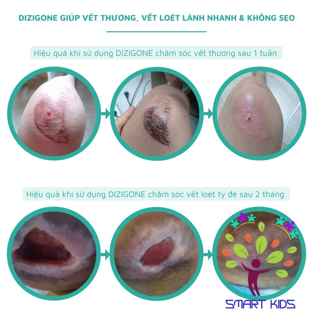 Dung Dịch Kháng Khuẩn Dizigone 500ml