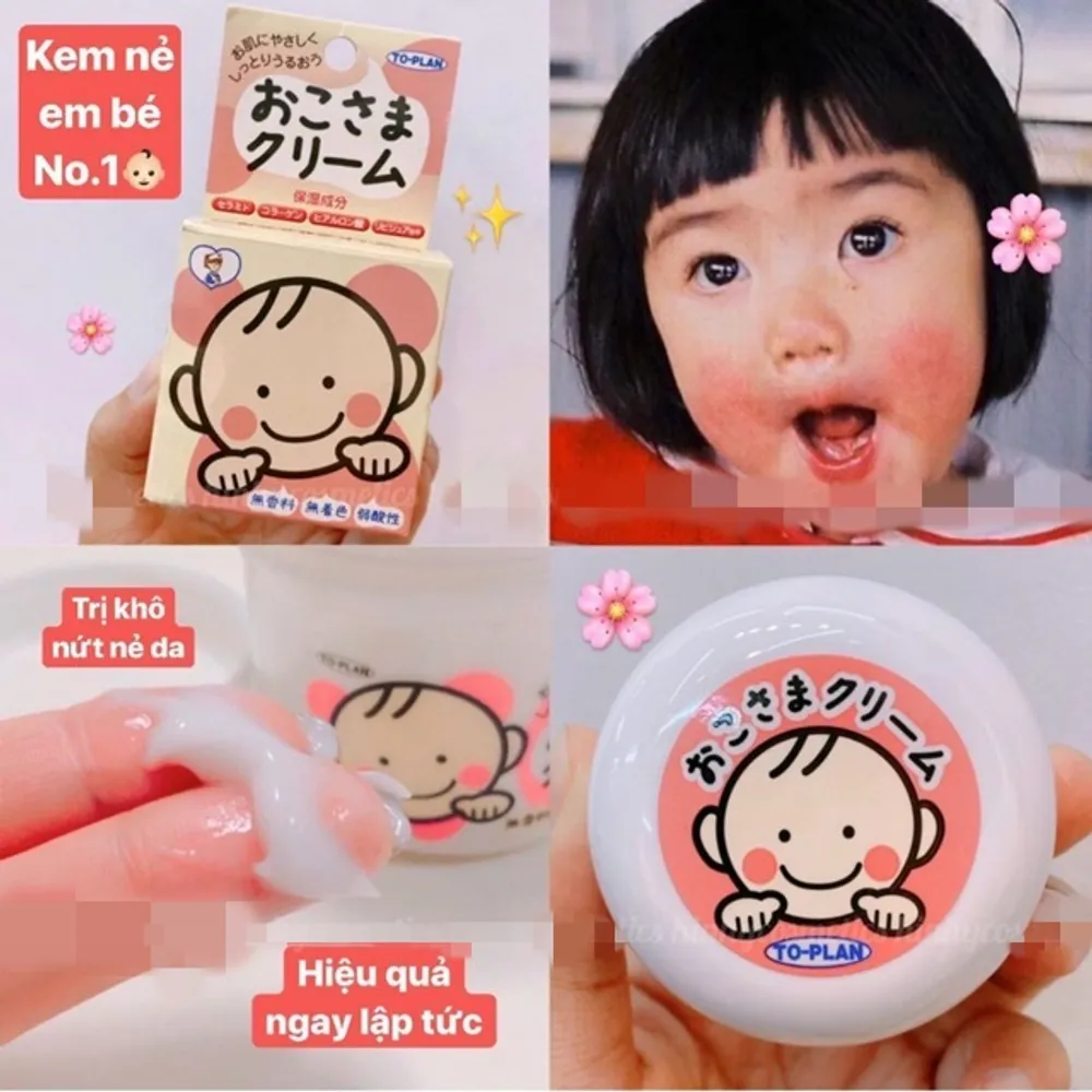 Kem nẻ To-plan Okosama Cream dùng cho mặt và body 110g