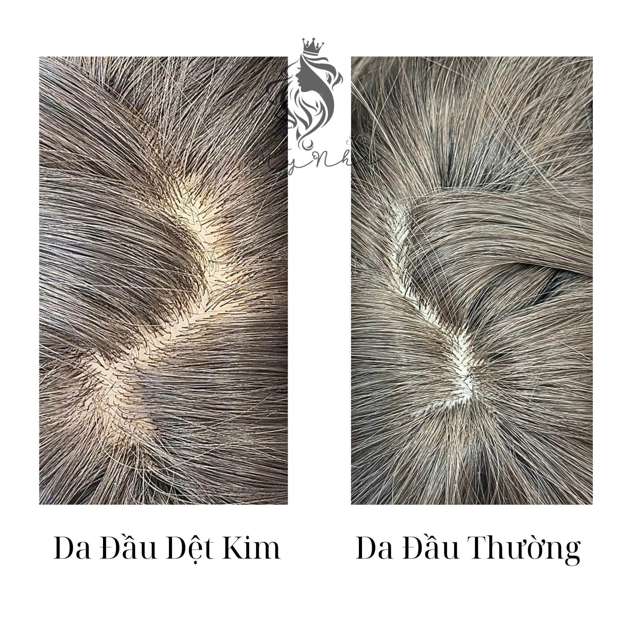 Tóc Giả CH009 Cúp