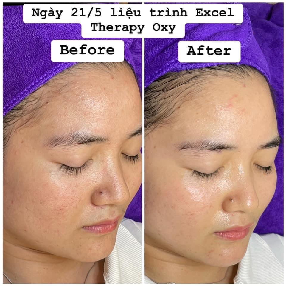 Liệu trình oxy tươi OXY TƯƠI EXCEL THERAPY O2 – GERMAINE DE CAPUCCINI ( LẺ)
