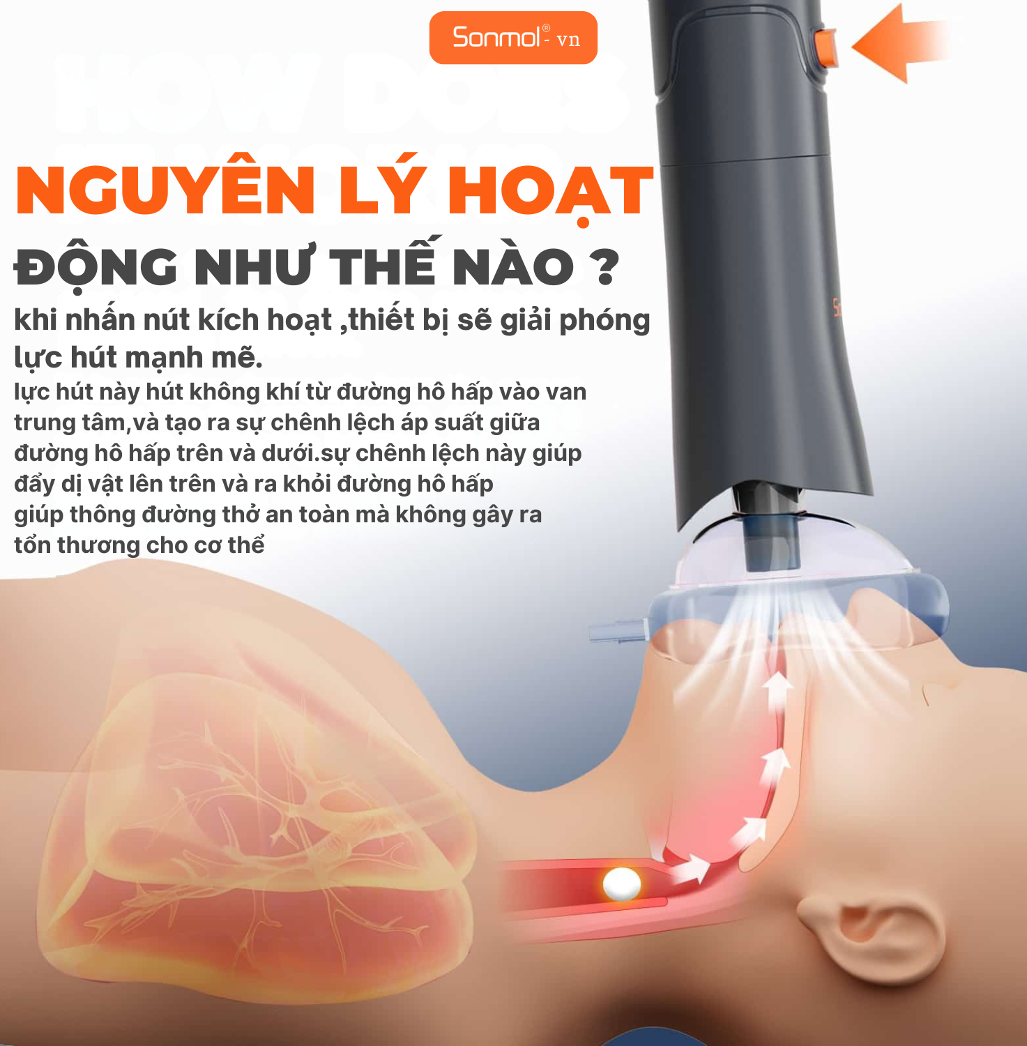 Thiết Bị Chống nghẹn dị vật Sonmol: Giải Pháp Cứu Người Khi Nghẹt Thở Hiệu Quả Nhất Hiện Nay