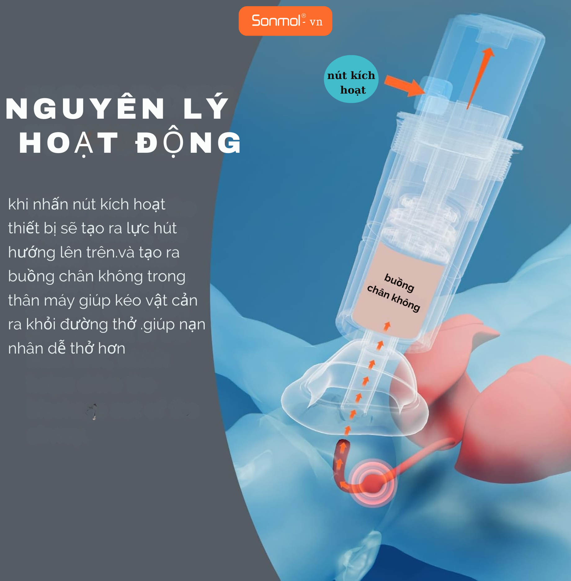 Dụng Cụ Hỗ Trợ Sơ Cứu Hóc Dị Vật Sonmol MFAC-08VC sản phẩm chính hãng