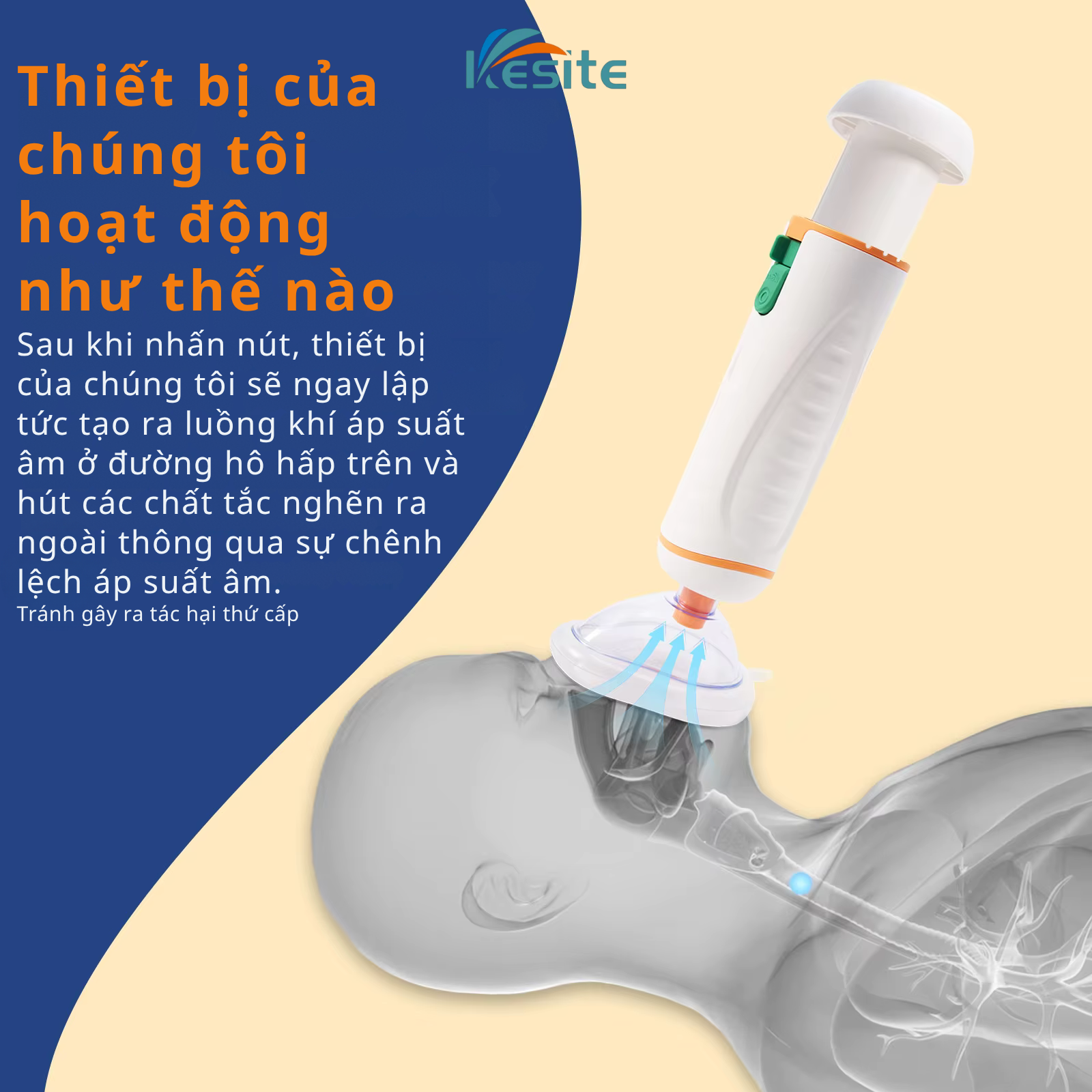 Dụng cụ hỗ trợ sơ cứu hóc dị vật KESITE model: Type IA chính hãng bảo hành 12 tháng