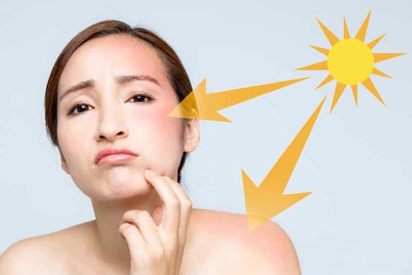 TẤT CẢ NHỮNG GÌ BẠN CẦN BIẾT VỀ VIỆC BẢO VỆ CHỐNG TIA UVA VÀ UVB