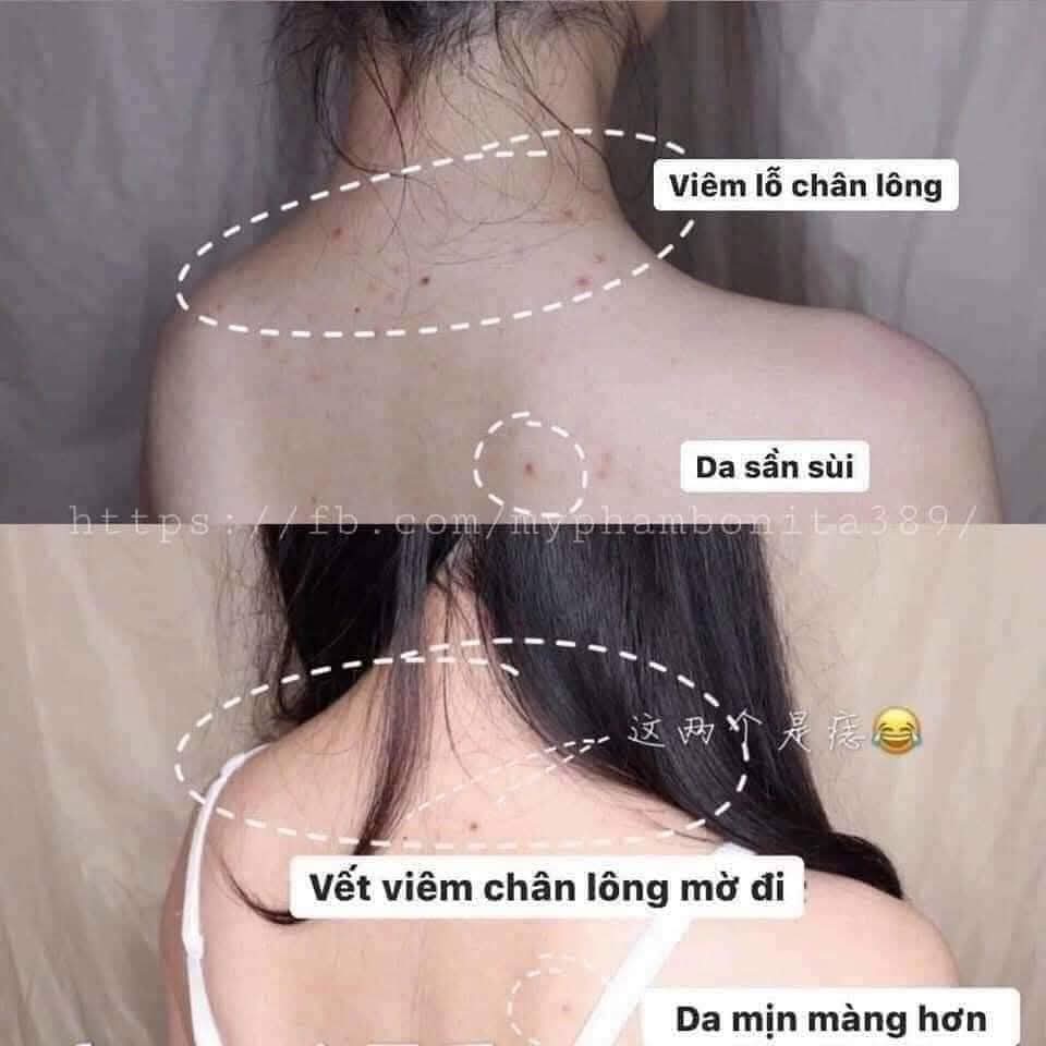 SÁP XÀ PHÒNG HỖ TRỢ GIẢM MỤN LƯNG HÀNG XỊN (8) '