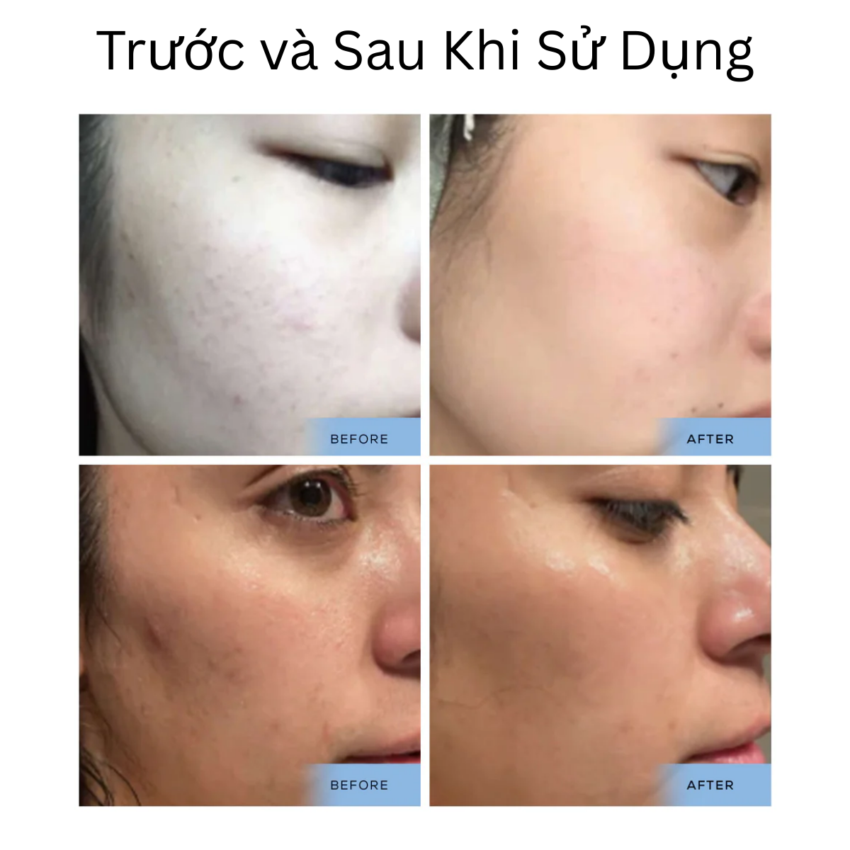 B5 Serum