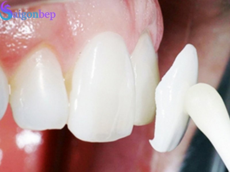 ứng dụng gốm thủy tinh