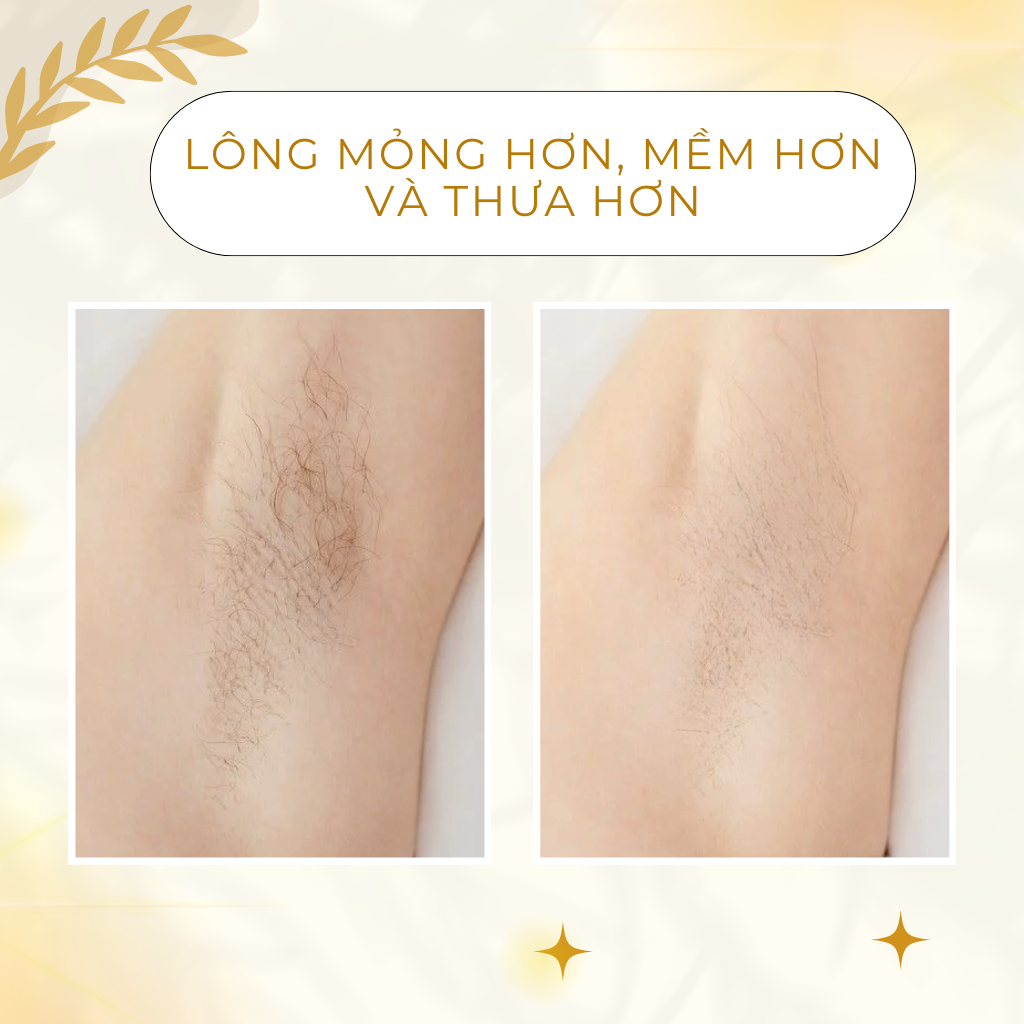 Serum Ức Chế Mọc Lông Siêu Hoạt Tính