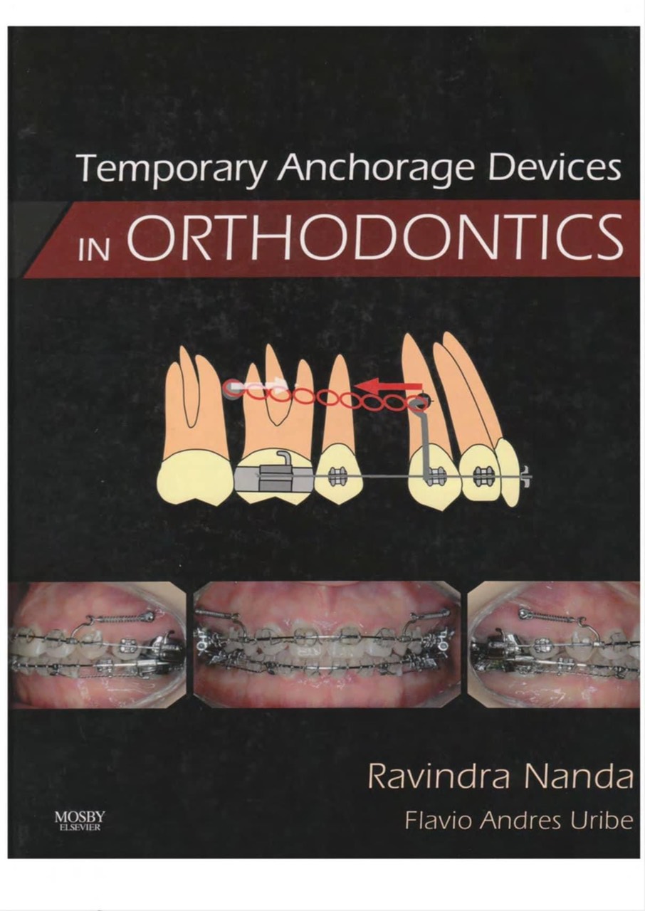 Temporary Anchorage Devices in Orthodontics