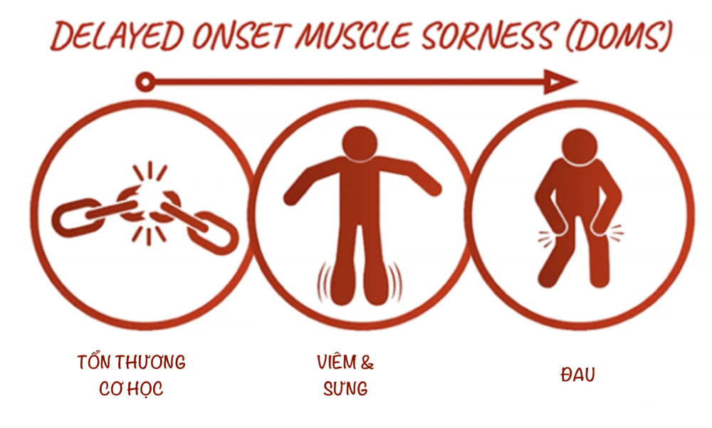 Đau cơ khởi phát muộn (DOMS)