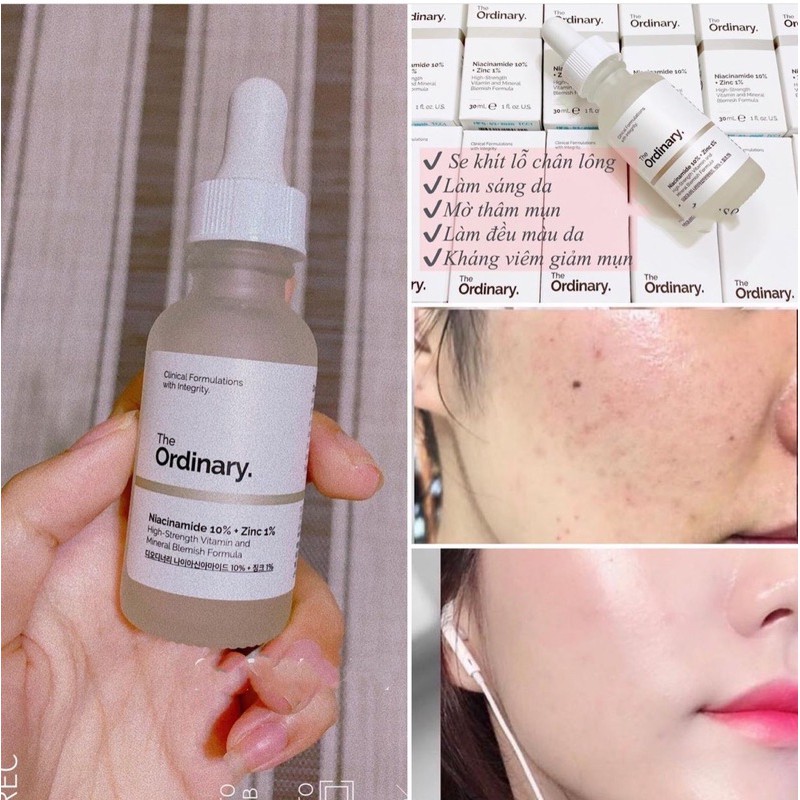 [FREE SHIP] Serum The Ordinary Mờ Thâm Mụn Sáng Da NIACINAMIDE 10% + Zinc