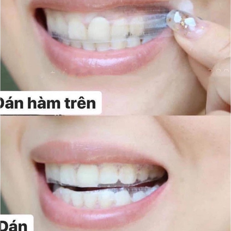 [FREE SHIP] Miếng Dán Trắng Răng 3D Crest Xịn