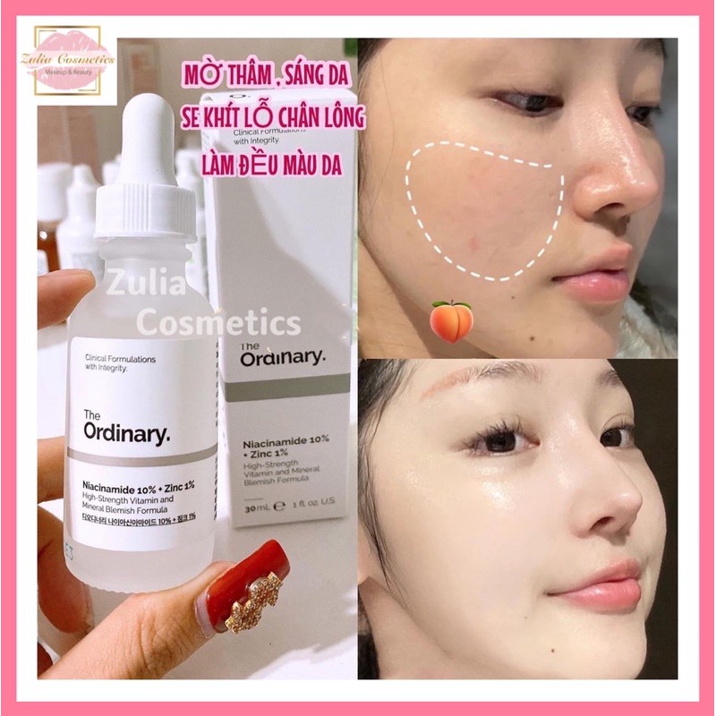 [FREE SHIP] Serum The Ordinary Mờ Thâm Mụn Sáng Da NIACINAMIDE 10% + Zinc