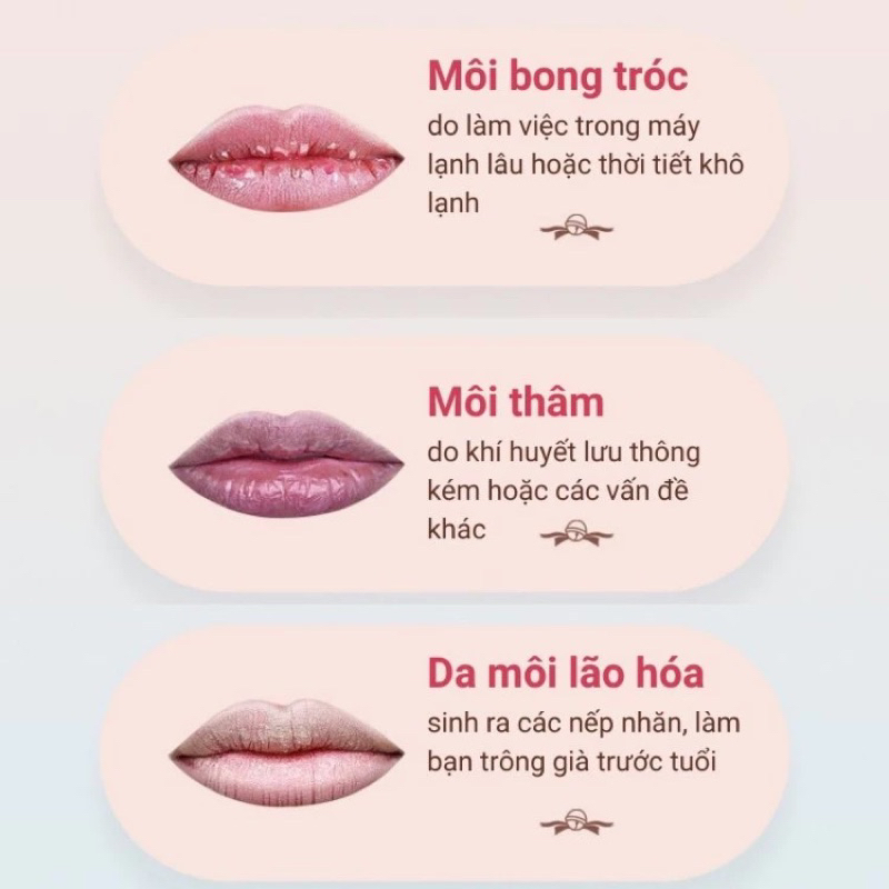 [UK] Son Dưỡng Môi Vaseline Lip Therapy Rosy Hộp Thiếc Màu Hồng 20g