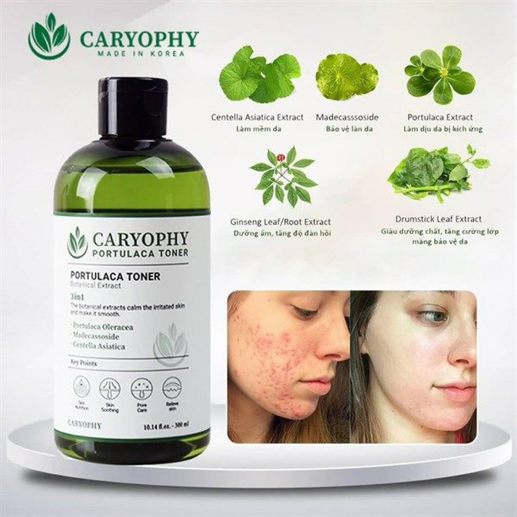 [CARYOPHY] Nước cân bằng Caryophy Portulaca Toner không cồn cho da mụn 300m (Hàng Công Ty)
