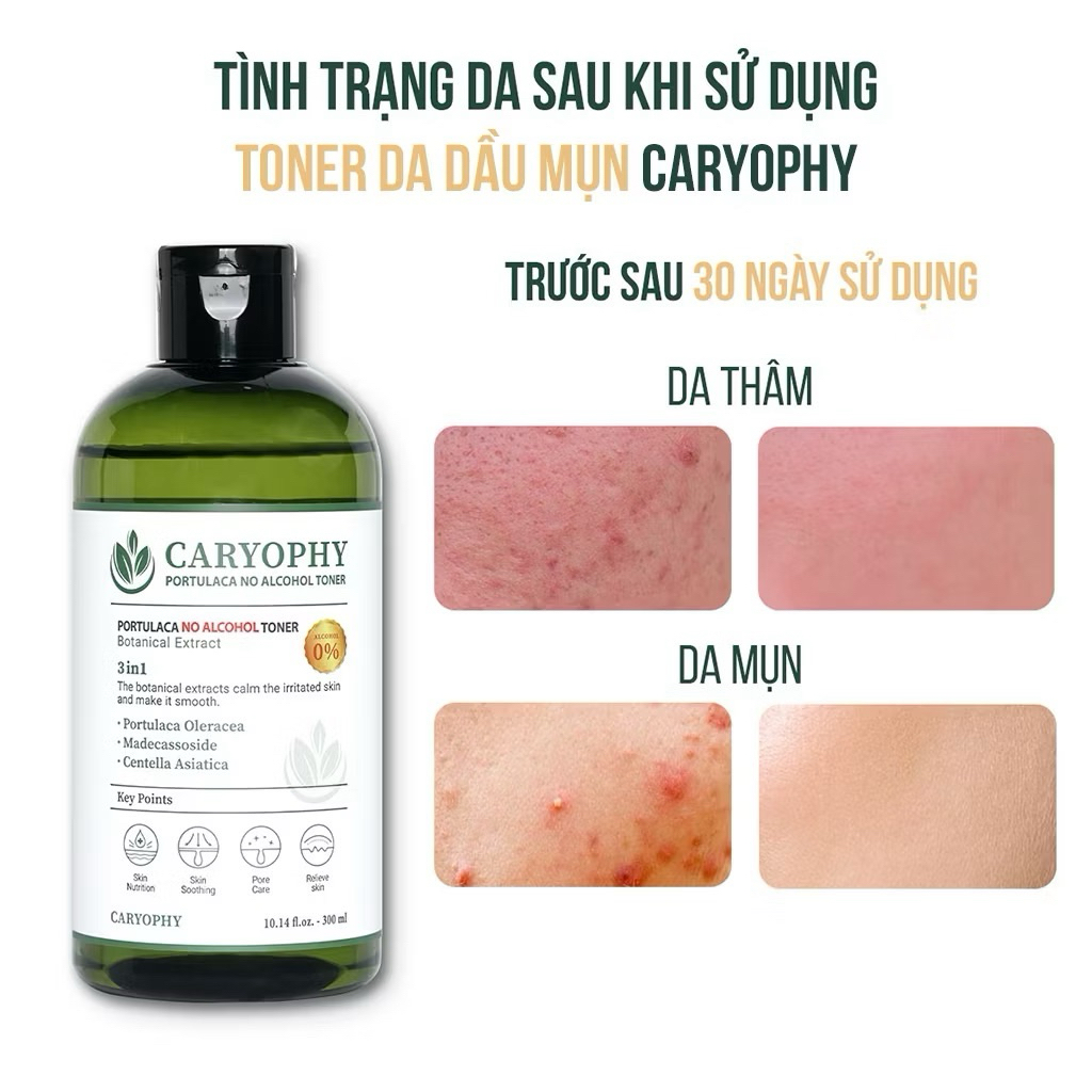 [CARYOPHY] Nước cân bằng Caryophy Portulaca Toner không cồn cho da mụn 300m (Hàng Công Ty)