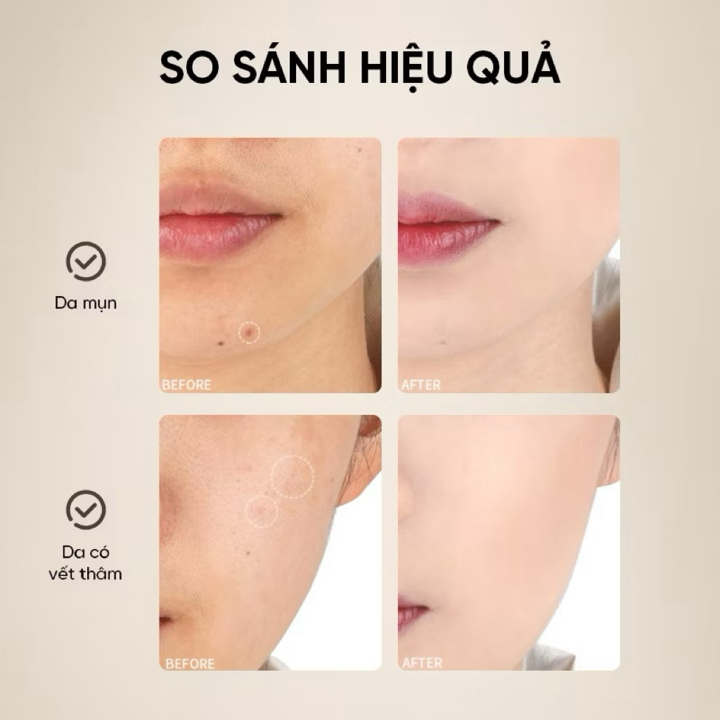 [AMORTALS] Bộ Cọ Mút Che Khuyết Điểm Amortals, 4 Đầu Chuyên Dụng, Che Phủ Tố, Không Bám Kem, Dễ Dùng Cho Người Mới