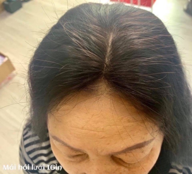 Tóc Giả Phủ Hói Phủ Bạc Đỉnh Đầu Không Mái 4D Cao Cấp – Mái Che Đỉnh Tự Nhiên, Tơ Mềm Như Tóc Thật, Kẹp Chắc Không Lộ