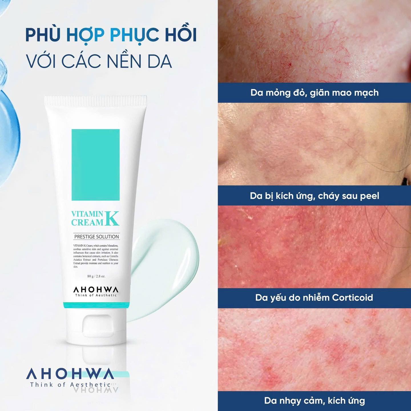 (Tuýp Mini) AHOHWA Kem Dưỡng Vitamin K 12G-Xanh Biển (Cty)