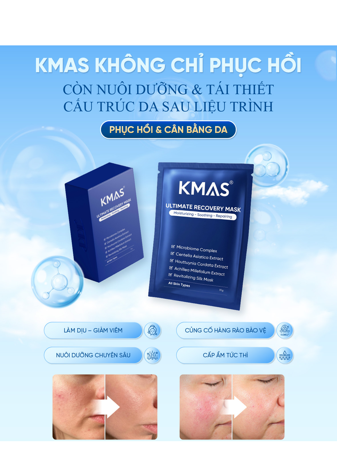 Kmas Ultimate Recovery Mask 10x30g (CTY)