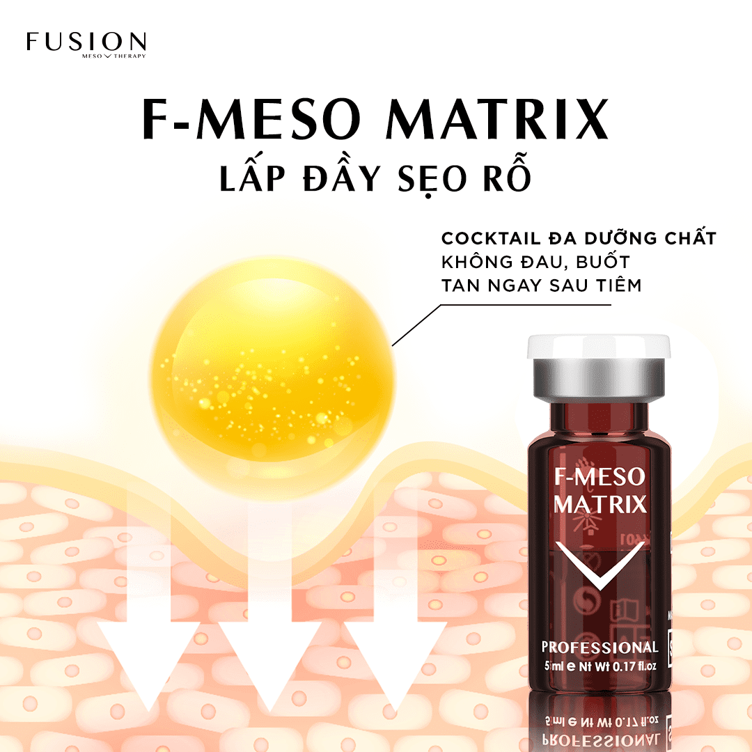 Fusion Meso F-Meso Matrix Hỗ Trợ Điều Trị Sẹo Rỗ Hộp 5X5Ml  (Cty)