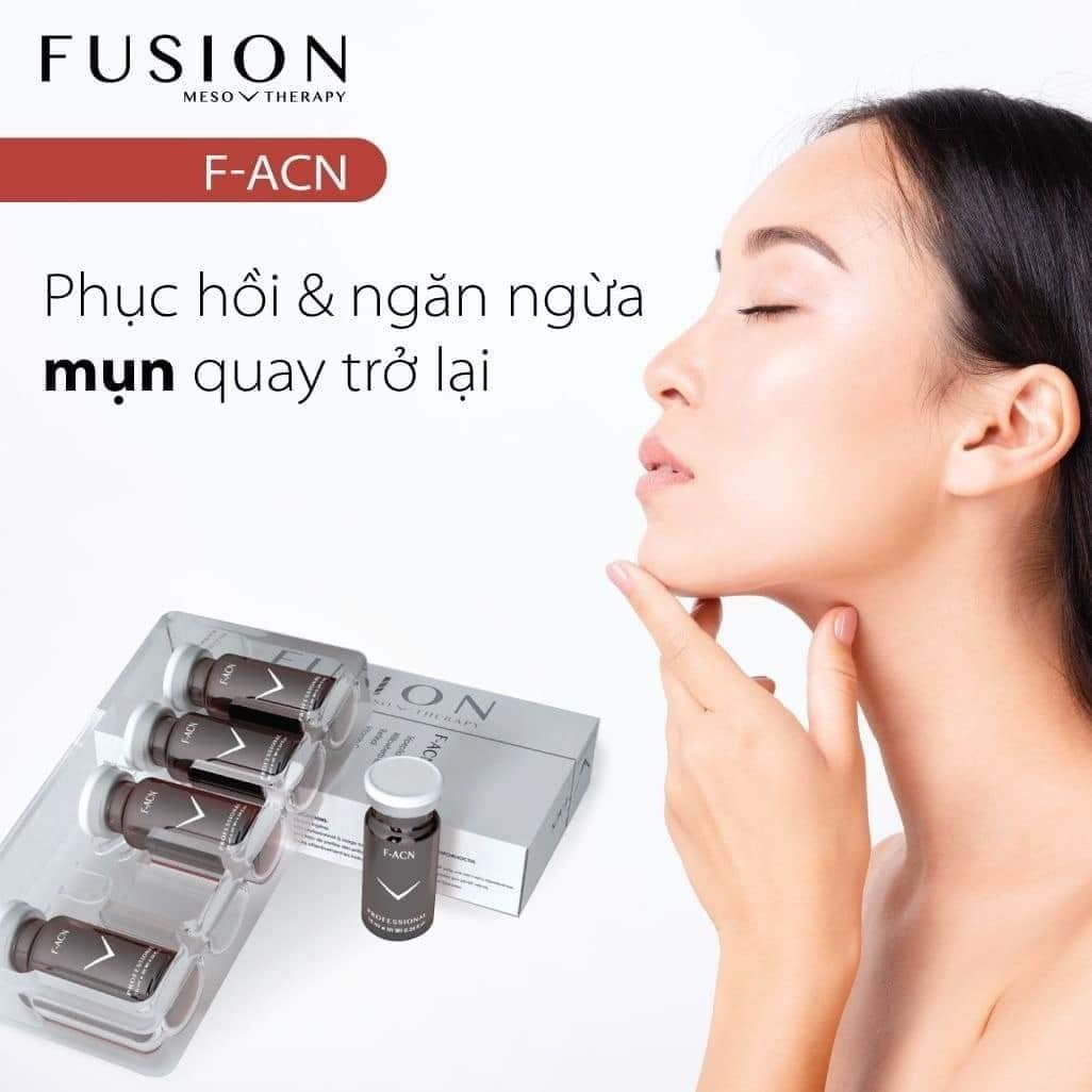 Fusion Meso F-Acn Kháng Viêm, Điều Trị Mụn Và Thâm Mụn 5 X 10Ml (Cty)