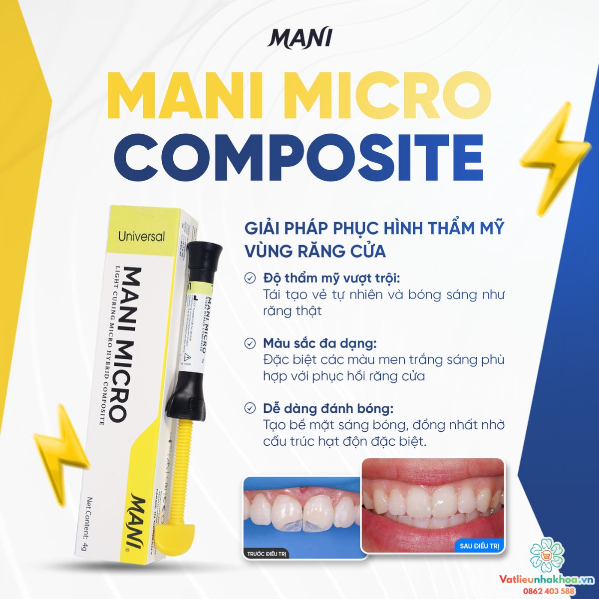 Composite đặc MANI MICRO - Tuýp 4g