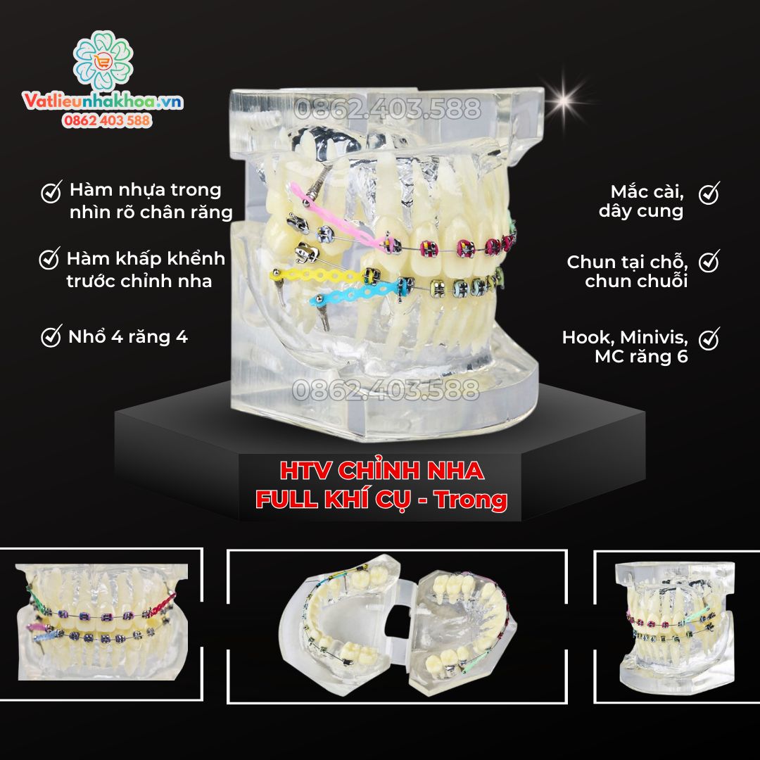 Hàm tư vấn chỉnh nha full khí cụ