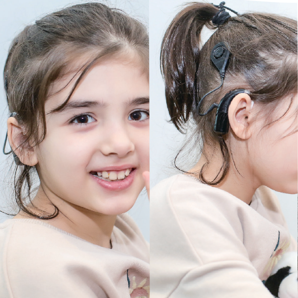 Cấy Ốc Tai Điện Tử Là Gì? Giải Pháp Phục Hồi Thính Lực Chuyên Sâu