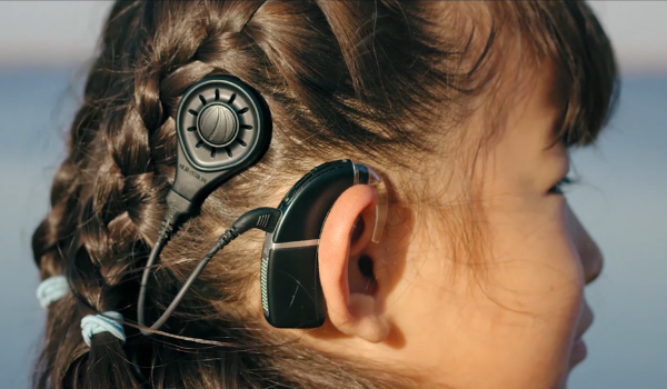 Trẻ em được cấy ốc tai điện tử Nurotron sớm giúp phục hồi khả năng nghe