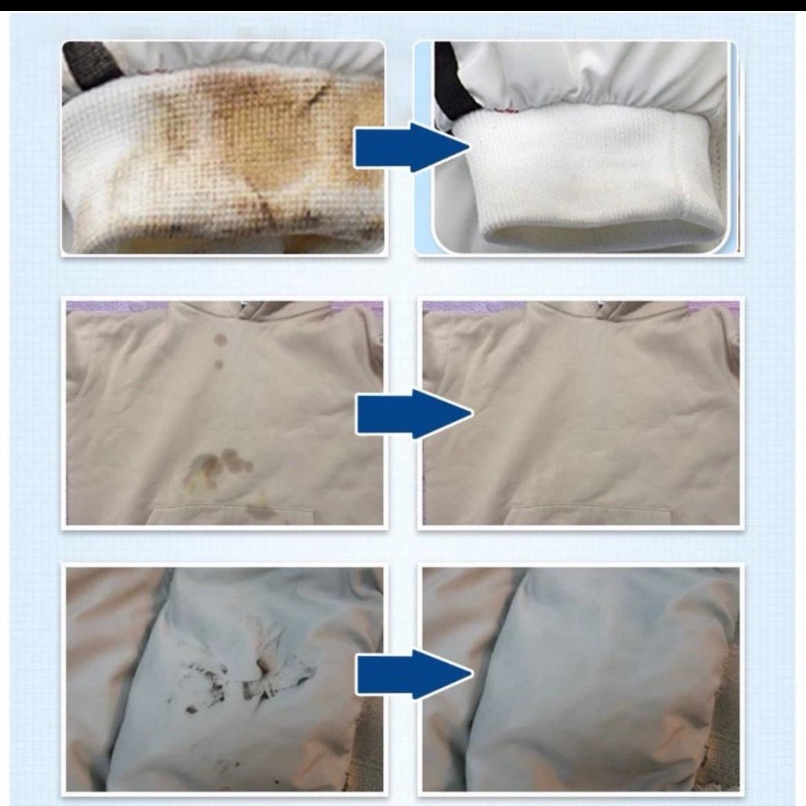 (Kutis Vietnam) 1 combo Bột Tẩy Thâm Kim Quần Áo Làm Sạch Vết Thâm Kim Giúp Áo Trắng Màu Sạch Hơn Mới Hơn Tiết Kiệm Chi Phí Tiện Lợi Cho Gia Đình Nội Trợ