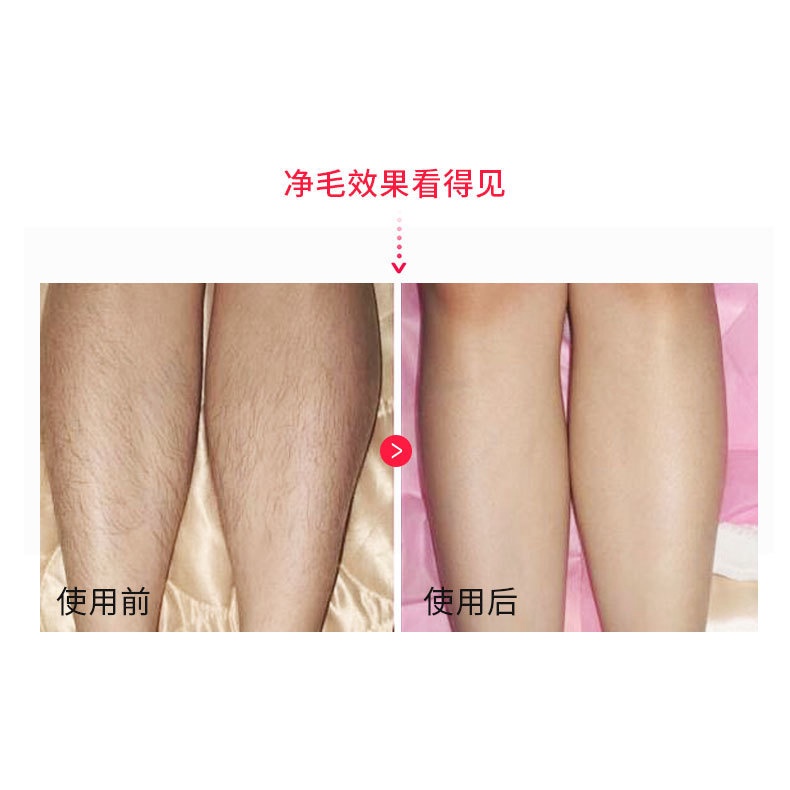Máy Tẩy Lông Cơ Thể Toàn Thân Kemei KM-5001