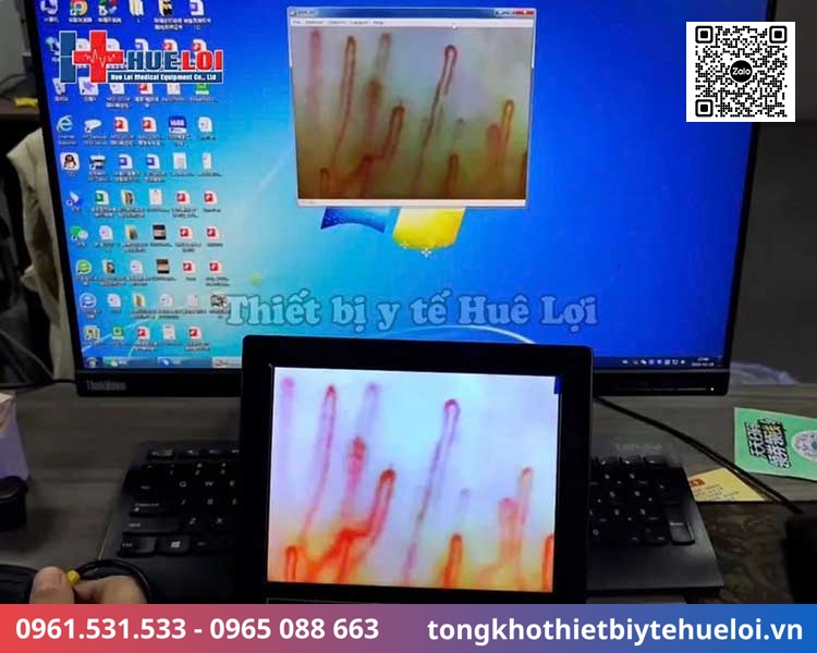 kính hiển vi soi mạch máu