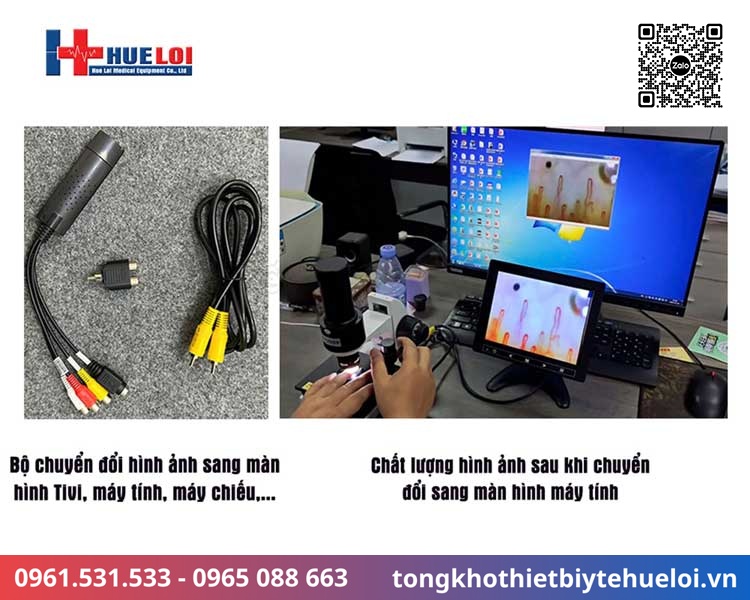 thiết bị chẩn đoán mạch máu