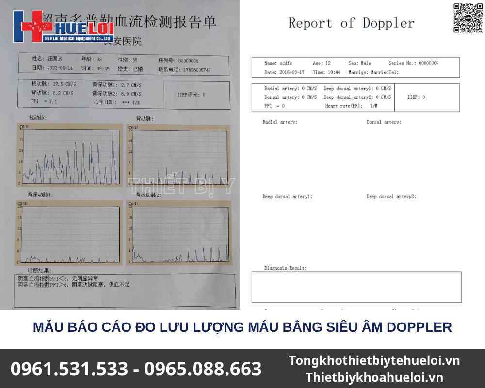 máy đo chức năng tình dục nam