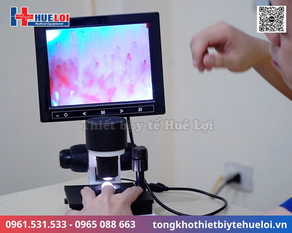 thiết bị soi mao mạch