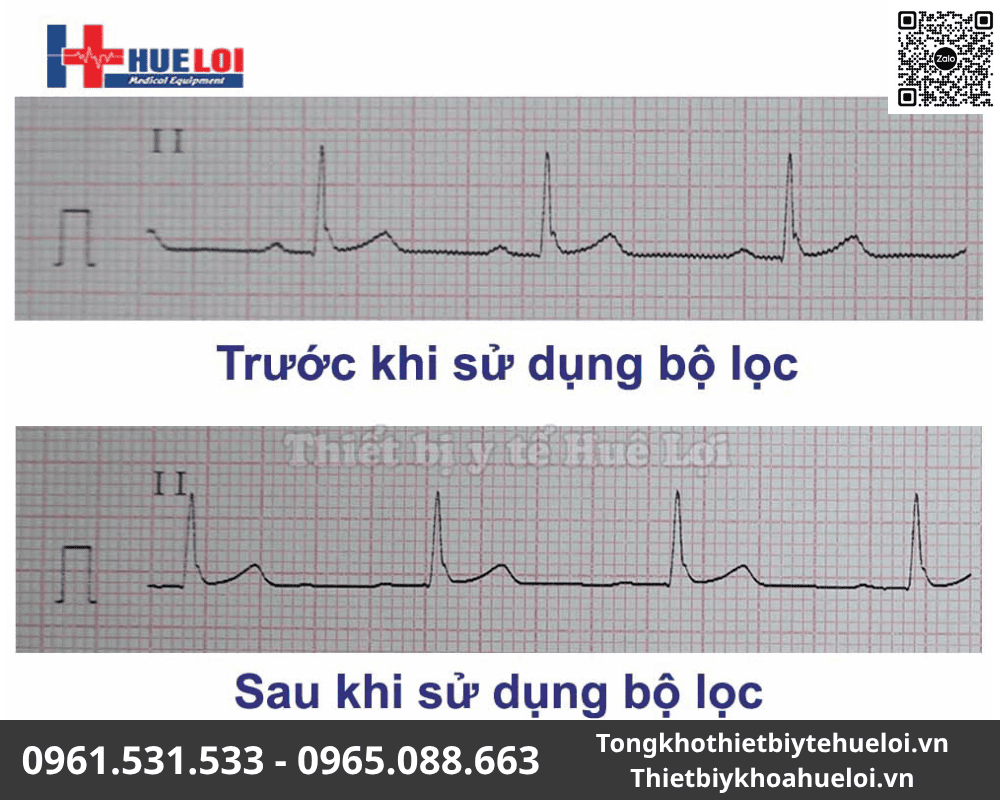 máy đo điện tim Contec